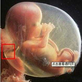 胎儿脐带连着母体哪,  第2张