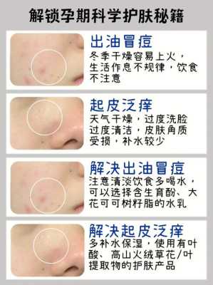 孕期护肤小常识(孕妇护肤品有哪些) 第1张 孕期护肤小常识(孕妇护肤品有哪些) 第1张