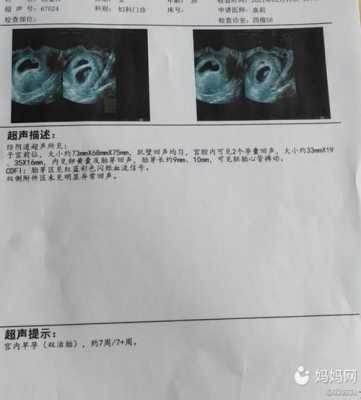 孕18周胎心153一定是女孩吗,胎心音辨别胎儿男女马蹄声 第2张 孕18周胎心153一定是女孩吗,胎心音辨别胎儿男女马蹄声 第2张