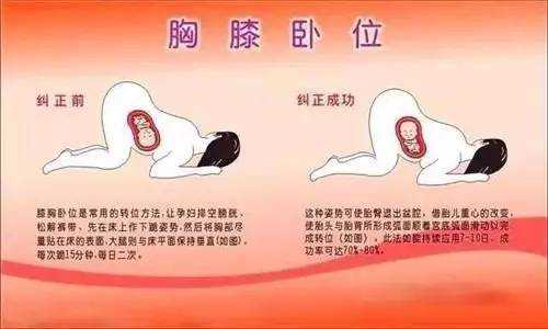 孕27周胎儿横位怎么办?胎儿胎位不正有什么办法可以纠正吗,怀孕27周胎儿真实图片 第3张 孕27周胎儿横位怎么办?胎儿胎位不正有什么办法可以纠正吗,怀孕27周胎儿真实图片 第3张