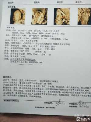 胎儿心脏彩超是四维吗(胎儿心脏彩超是四维吗还是四维) 第1张 胎儿心脏彩超是四维吗(胎儿心脏彩超是四维吗还是四维) 第1张