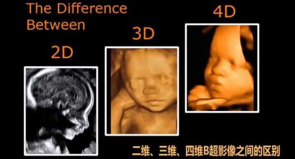 胎儿五个月四维彩超(做四维彩超是什么时候) 第3张 胎儿五个月四维彩超(做四维彩超是什么时候) 第3张