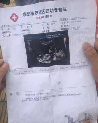 彩超隔多久可以做一次啊?一般情况下怀孕后要做几次彩超,怀孕期间要做几次b超检查 第2张 彩超隔多久可以做一次啊?一般情况下怀孕后要做几次彩超,怀孕期间要做几次b超检查 第2张