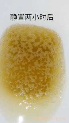 孕期尿液很黄是怎么回事,怀孕期间尿黄正常吗对胎儿有影响吗 第2张 孕期尿液很黄是怎么回事,怀孕期间尿黄正常吗对胎儿有影响吗 第2张
