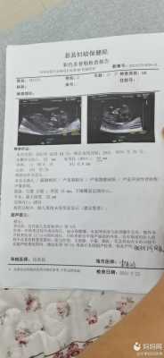 胎儿胃泡(怀孕19周做2维彩超说胎儿胃泡显示不清。怎么办) 第1张 胎儿胃泡(怀孕19周做2维彩超说胎儿胃泡显示不清。怎么办) 第1张