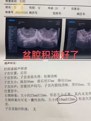 孕期有积液有什么影响(怀孕有积液是什么原因造成的) 第1张 孕期有积液有什么影响(怀孕有积液是什么原因造成的) 第1张