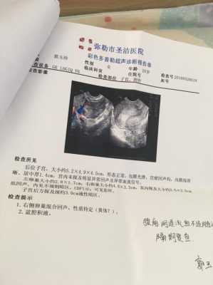 孕期有积液有什么影响(怀孕有积液是什么原因造成的) 第2张 孕期有积液有什么影响(怀孕有积液是什么原因造成的) 第2张