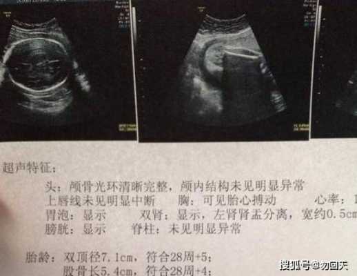 b超胎儿体重（b超胎儿体重和实际的相差多少）  第1张