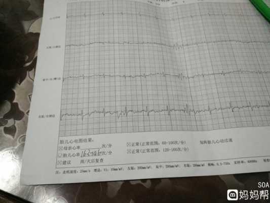 胎儿心电图(怀孕多少周能做心电图,血常规啊) 第2张 胎儿心电图(怀孕多少周能做心电图,血常规啊) 第2张