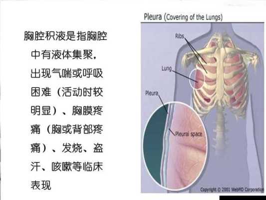 胎儿胸腔积液（胎儿胸腔积液是什么原因造成的）  第2张