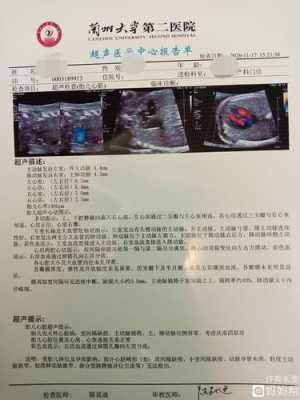 胎儿心脏超声(胎儿心脏超声多少周做合适) 第2张 胎儿心脏超声(胎儿心脏超声多少周做合适) 第2张
