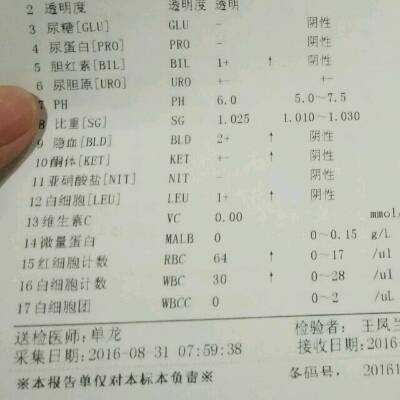 孕妇尿检上皮细胞高是怎么回事,  第2张