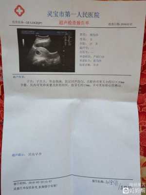 胎儿胚芽（胎芽多大的时候出现胎心）  第3张