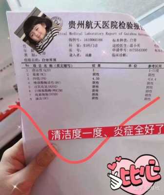 孕期一停药霉菌就复发(孕期一停药霉菌就复发怎么办) 第2张 孕期一停药霉菌就复发(孕期一停药霉菌就复发怎么办) 第2张