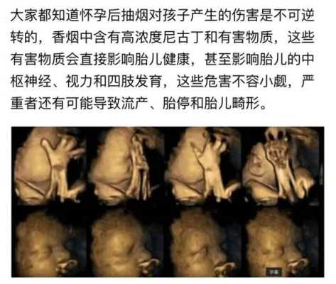 孕期吸烟对胎儿的影响(孕期吸烟对胎儿的影响) 第2张 孕期吸烟对胎儿的影响(孕期吸烟对胎儿的影响) 第2张