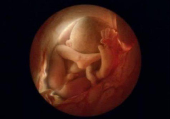 胎儿摄影（炫尼baby胎儿摄影）  第1张