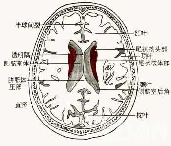 胎儿侧脑室后角(胎儿侧脑室后角) 第2张 胎儿侧脑室后角(胎儿侧脑室后角) 第2张