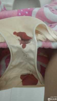 孕期流鲜红的血不要怕(请问孕妇拉大便出血鲜红不痛是怎么回事呀,胎儿会不会有问题呢) 第2张 孕期流鲜红的血不要怕(请问孕妇拉大便出血鲜红不痛是怎么回事呀,胎儿会不会有问题呢) 第2张