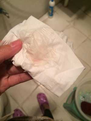 孕期流鲜红的血不要怕(请问孕妇拉大便出血鲜红不痛是怎么回事呀,胎儿会不会有问题呢) 第1张 孕期流鲜红的血不要怕(请问孕妇拉大便出血鲜红不痛是怎么回事呀,胎儿会不会有问题呢) 第1张