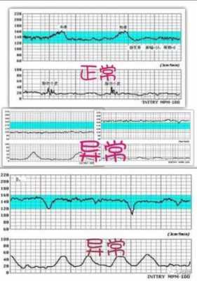 胎儿的心率是多少正常范围,胎儿没有心跳是什么原因造成的 第1张 胎儿的心率是多少正常范围,胎儿没有心跳是什么原因造成的 第1张