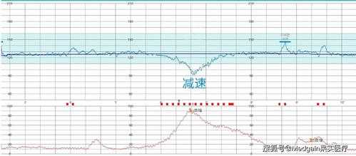 胎儿的心率是多少正常范围,胎儿没有心跳是什么原因造成的 第2张 胎儿的心率是多少正常范围,胎儿没有心跳是什么原因造成的 第2张