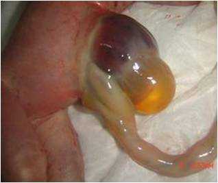 脐膨出是什么,胎儿脐膨出是什么原因引起的  第1张