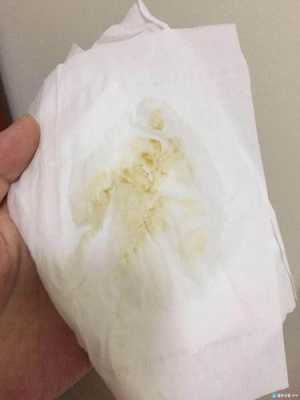 怀孕期间还有白带吗(如果怀孕了还会来白带吗) 第3张 怀孕期间还有白带吗(如果怀孕了还会来白带吗) 第3张