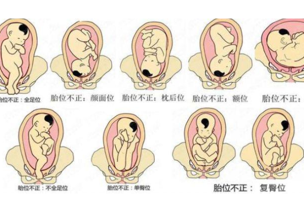 胎儿正常胎位（胎儿什么时候定胎位）  第1张