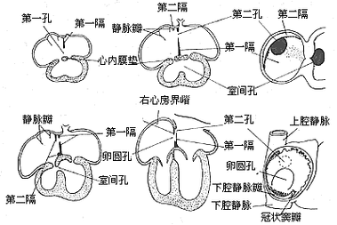 胎儿心脏异常孕期表现（怀孕七个月胎儿心脏室间隔穿隔血流怎么回事）  第3张