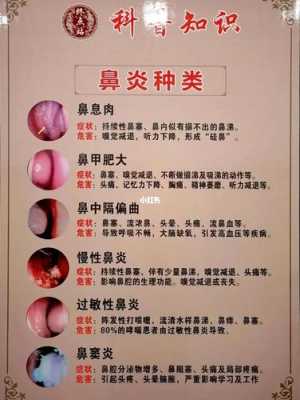 孕期鼻炎犯了怎样治疗(孕期有鼻炎怎么办) 第2张 孕期鼻炎犯了怎样治疗(孕期有鼻炎怎么办) 第2张