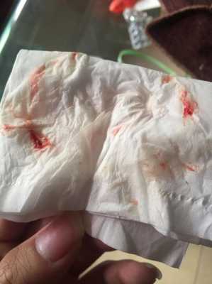 孕期鼻涕带血是什么原因(孕妇感冒流鼻涕怎么办呢) 第2张 孕期鼻涕带血是什么原因(孕妇感冒流鼻涕怎么办呢) 第2张