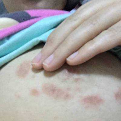 怀孕期间乳房痒是怎么回事(孕期胸痒越抓越痒怎么缓解) 第3张 怀孕期间乳房痒是怎么回事(孕期胸痒越抓越痒怎么缓解) 第3张