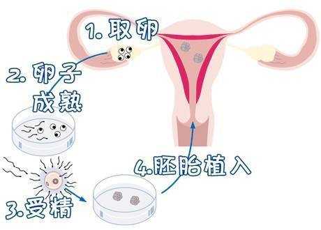 易孕期体外受精会怀孕吗(易孕期体外受精会怀孕吗女性) 第2张 易孕期体外受精会怀孕吗(易孕期体外受精会怀孕吗女性) 第2张