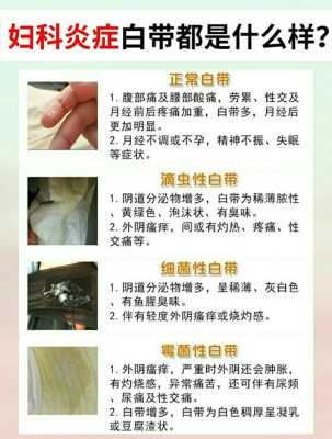 孕期白带异常会影响胎儿吗（怀孕期间白带异常怎么办）  第2张