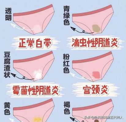 孕期白带异常会影响胎儿吗（怀孕期间白带异常怎么办）  第3张