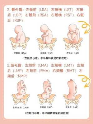 左枕前位和左枕后位有什么区别,胎儿右枕前位图片示意图  第1张