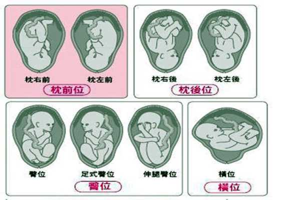 左枕前位和左枕后位有什么区别,胎儿右枕前位图片示意图  第2张