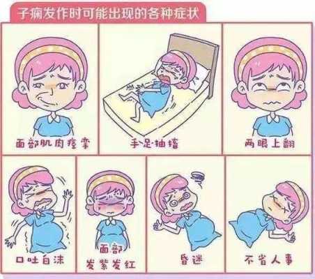 孕期重度子痫(孕期重度子痫前期是什么病啊) 第2张 孕期重度子痫(孕期重度子痫前期是什么病啊) 第2张