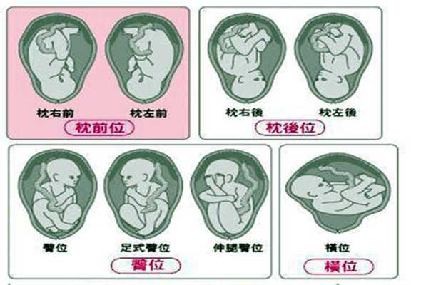 孕30周胎位头位是什么意思,29周胎儿头位是什么意思  第2张