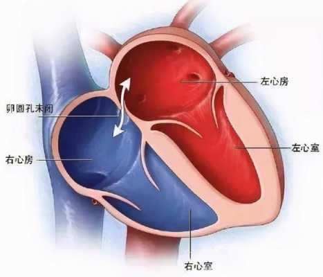 胎儿卵圆孔偏大(胎儿卵圆孔偏大是什么原因造成的) 第1张 胎儿卵圆孔偏大(胎儿卵圆孔偏大是什么原因造成的) 第1张
