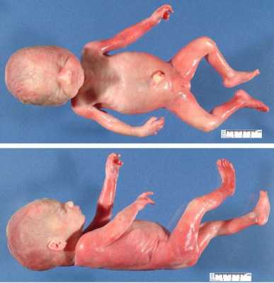 怀孕8周胎儿图片（胎儿胎心快是什么原因造成的啊？孕八个月多了，要做什么检查好）  第1张