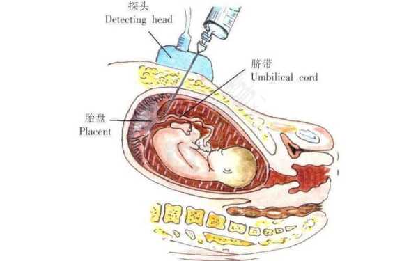 做脐带血穿刺会对胎儿有什么影响吗？会不会影响胎儿发育,胎儿脐带血穿刺多久出结果  第2张