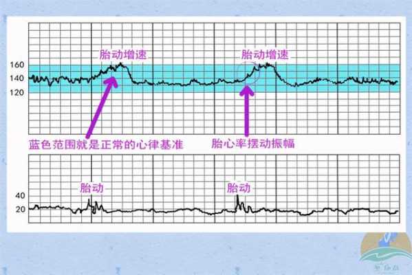 孕13周左右家里胎心仪听胎心总是165-175,胎儿心率175正常吗  第1张