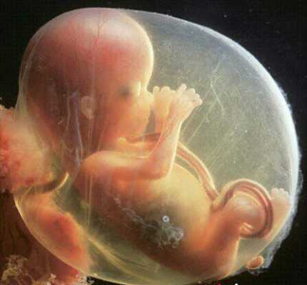 4个月胎儿的模样是什么样子的？都发育什么了,怀孕4个月胎儿图片男孩  第2张