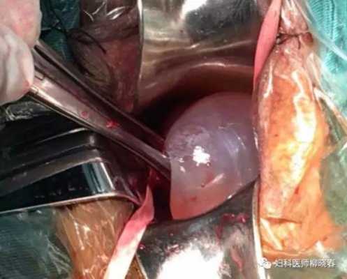 胎儿从哪里出来(宝宝吞了塑料异物会自己排出吗) 第2张 胎儿从哪里出来(宝宝吞了塑料异物会自己排出吗) 第2张