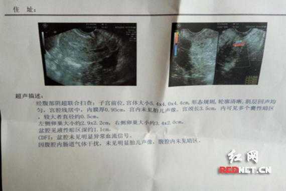 孕期体检时间及项目（怀孕做B超，做两次B超的间隔时间应该是多长）  第2张