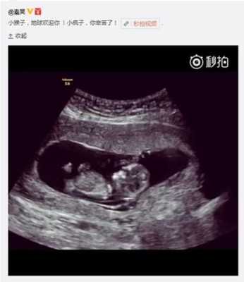 孕期体检时间及项目（怀孕做B超，做两次B超的间隔时间应该是多长）  第3张