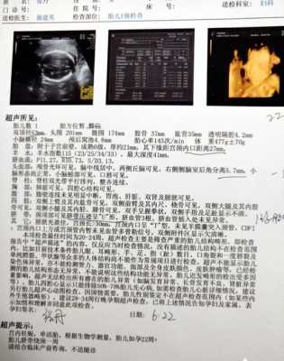 怀孕几个月会有心跳要怎么检测得到的,胎儿几个月有心跳声音 第2张 怀孕几个月会有心跳要怎么检测得到的,胎儿几个月有心跳声音 第2张