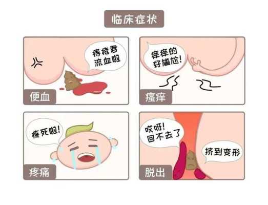 痔疮对胎儿有影响吗（孕妇有痔疮对胎儿有影响吗）  第3张