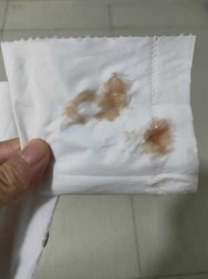 孕期白带有点褐色(白带中带褐色是怎么回事。该怎么治疗) 第2张 孕期白带有点褐色(白带中带褐色是怎么回事。该怎么治疗) 第2张